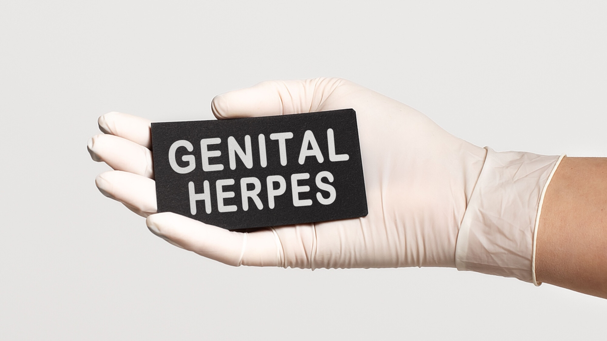 Genitalherpes - Was steckt hinter der Tabu-Erkrankung?